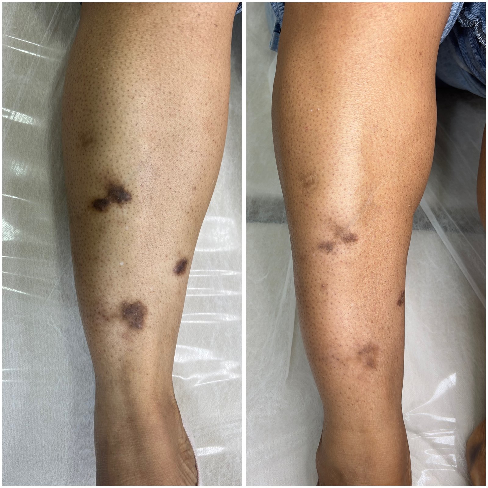 Camuflagem de Manchas
