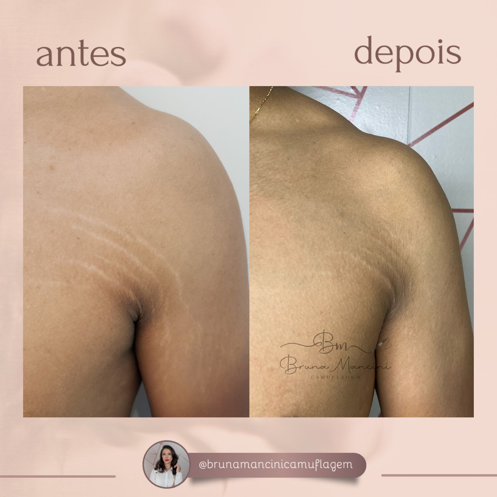 Pele Transformada